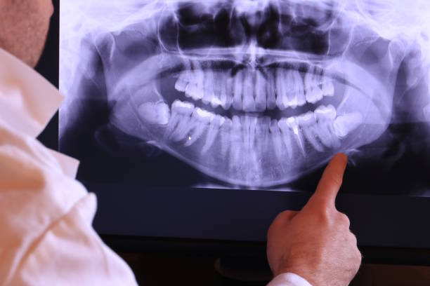 Best Emergency Care for Gum Disease in Silverdale, WA